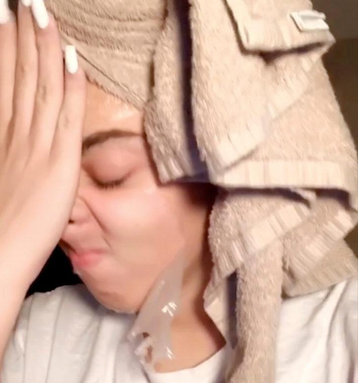 Güzellik uğruna çekilen eziyet! Yüzüne yapışan maskeyi acı içinde çıkardı G4