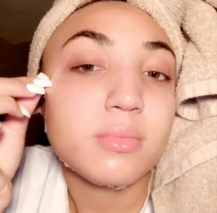 Güzellik uğruna çekilen eziyet! Yüzüne yapışan maskeyi acı içinde çıkardı G1