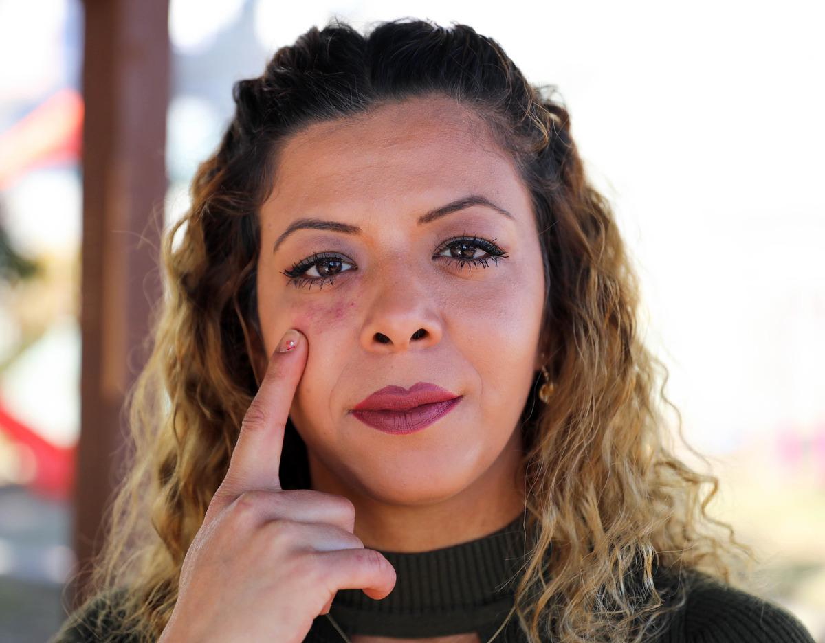 Evlatlık olduğunu &ouml;ğrenen Dilek Yakar ger&ccedil;ek ailesini arıyor! Tek ipucuysa doğum lekesi