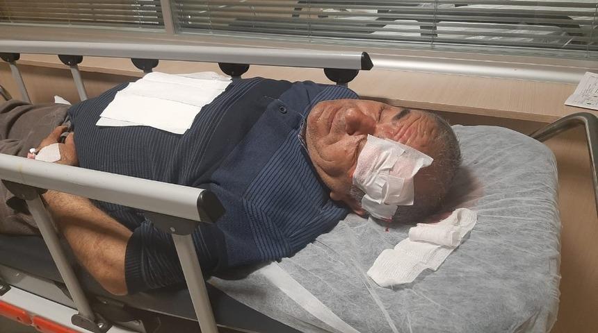 Adıyaman’da alacak verecek kavgası: 4 yaralı