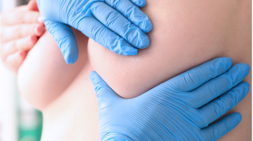 50 yaş üstü kadınlarda kilo vermek meme kanserine yakalanma riskini azaltabilir 