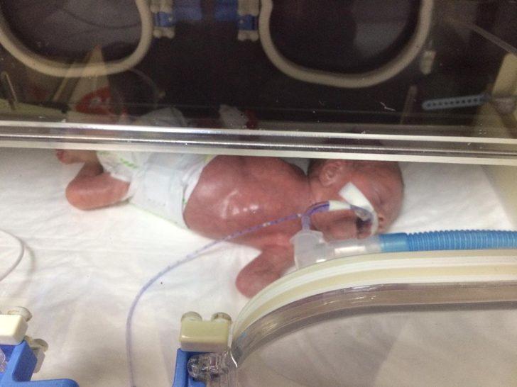 ‘Parmak bebek’ olarak doğdu ama pes etmedi! G3