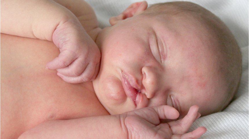 Bilinçsiz vitamin ve ilaç kullanmak dudak ve damak yarığı riskine yol açıyor