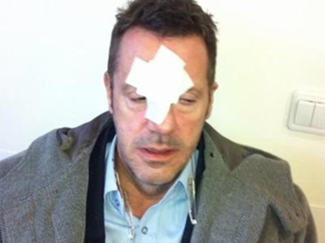 Can Tanrıyar saldırıya uğradı