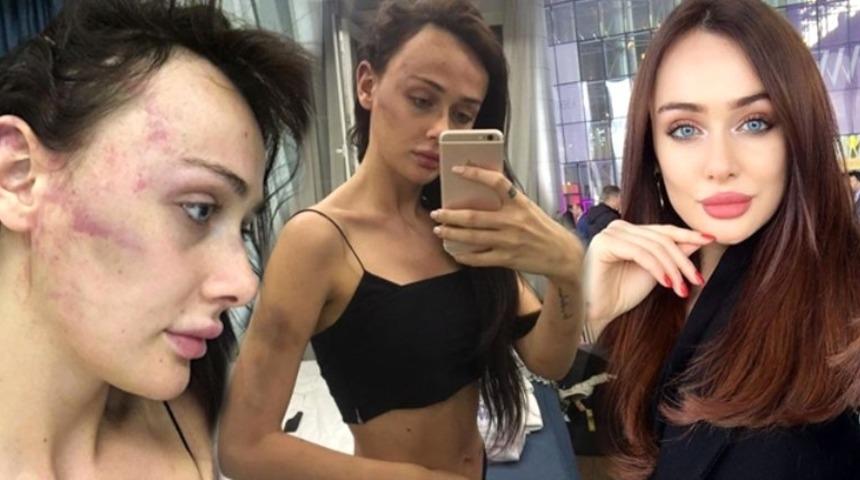 Sırp model Ortaköy'de dehşeti yaşamıştı! Yeni gelişme