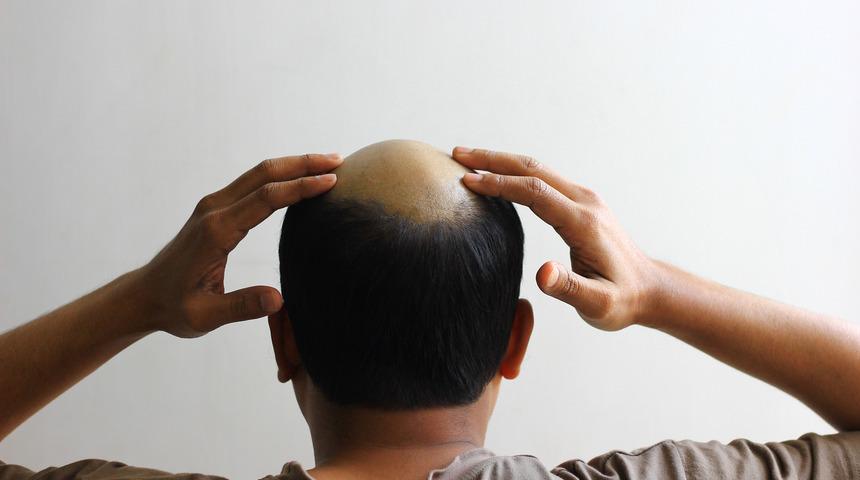 'Kafa nakli 10 yıl içinde mümkün olabilir' iddiası