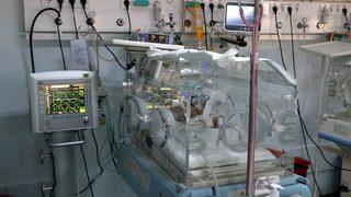 Mide ve bağırsakları dışarıda doğan bebek sağlığına kavuşturuldu