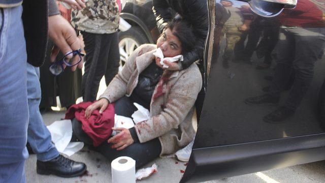 GÜNCELLEME - Otomobilde yanında oturan kadını ağzından bıçakladı