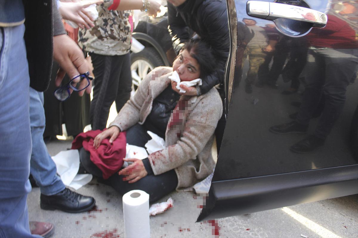 Vahşetin b&ouml;ylesi! Otomobil kullanırken yanında oturan kadını ağzından bı&ccedil;akladı