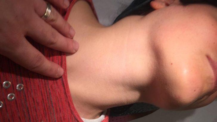 7 santimlik kanserli lenf bezleri 10 saatte temizlendi G4