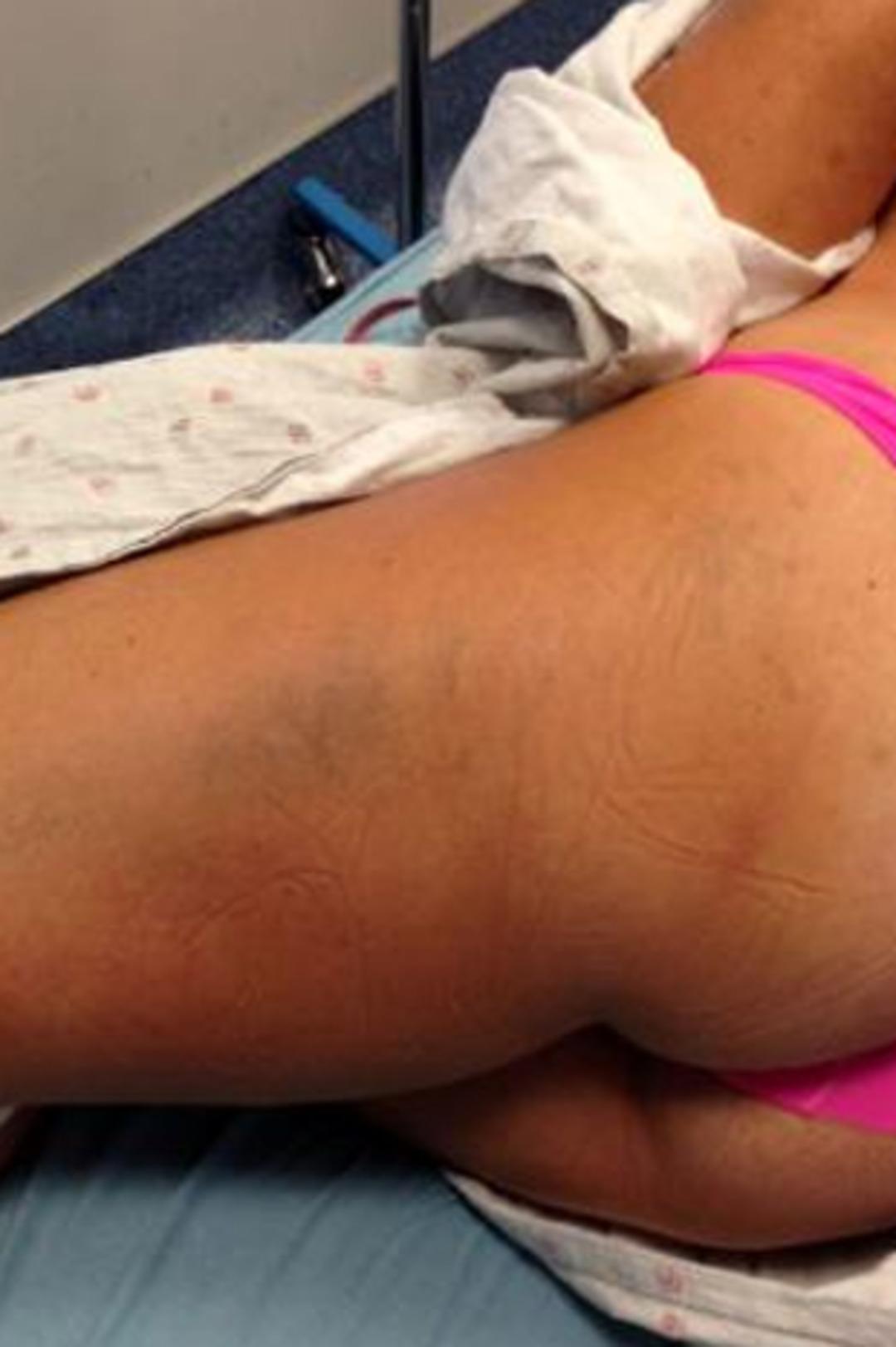 Atladıktan sonra bu hale geldi