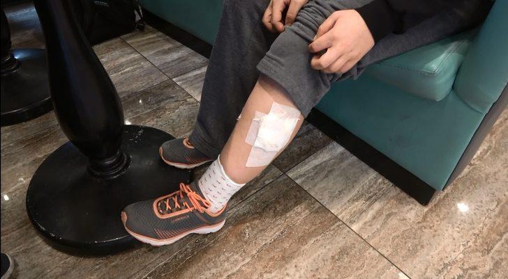 Başıboş köpekler dehşet saçtı... Genç kız canını zor kurtardı: Çok korkunç bir şeydi G5