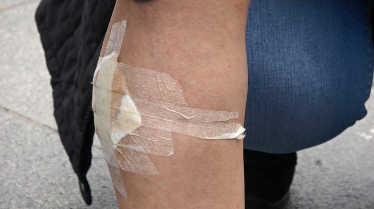 Başıboş köpekler dehşet saçtı... Genç kız canını zor kurtardı: Çok korkunç bir şeydi G1