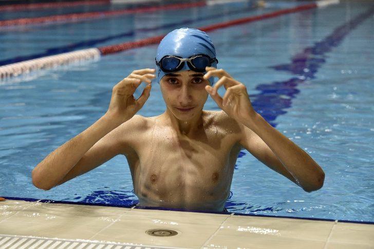 Yüzerek ameliyattan kurtuldular G3