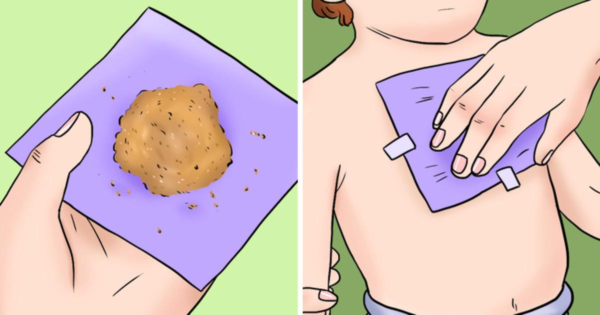 Bu y&ouml;ntemler &ccedil;ok işinize yarayacak! &Ccedil;ocuğunuzun &ouml;ks&uuml;r&uuml;ğ&uuml;n&uuml; hızlıca ge&ccedil;iren etkili tarifler