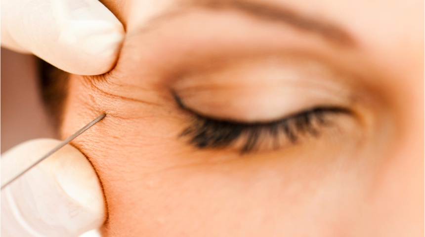 Botoks yaptırayım derken gözünüzü kaybetmeyin