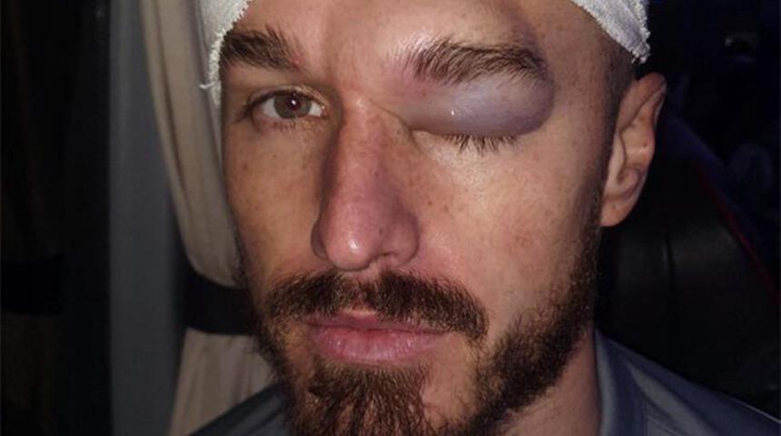 Joe Bennett'ın yüzü tanınmaz hale geldi