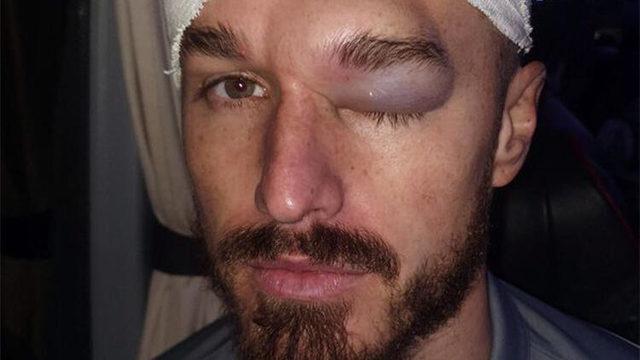 Joe Bennett'ın yüzü tanınmaz hale geldi