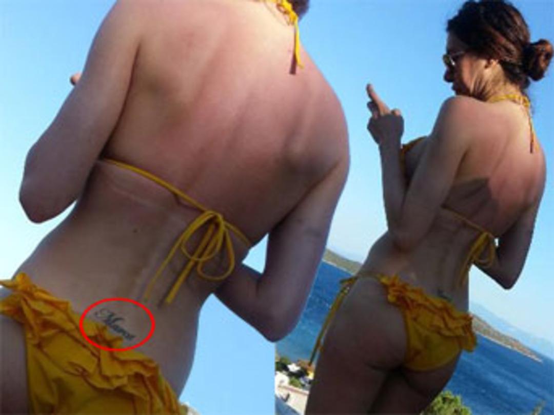 D&ouml;vmeyi sildirmedi