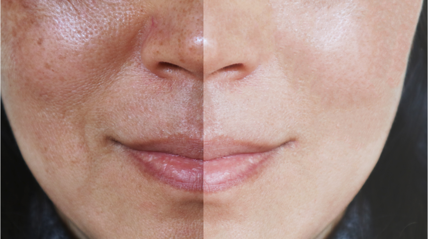 Kışın cilt bakımı nasıl olmalı? İşte ışıl ışıl cilt için tüyolar