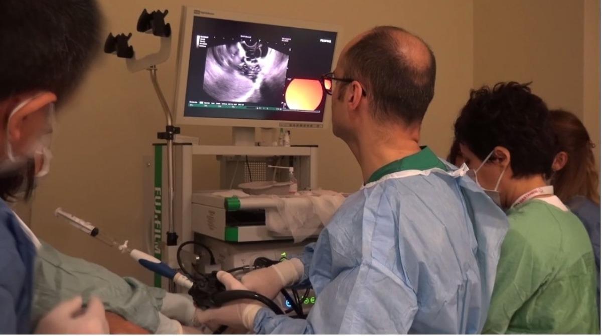 T&uuml;rkiye&rsquo;de az kullanılan y&ouml;ntem Kayseri Şehir Hastanesinde başarı ile uygulandı