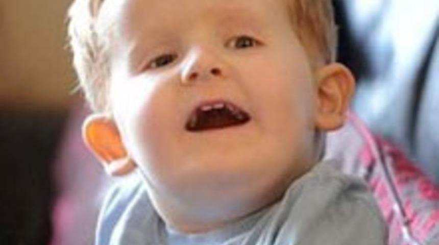 Hastalığının Adı Yok