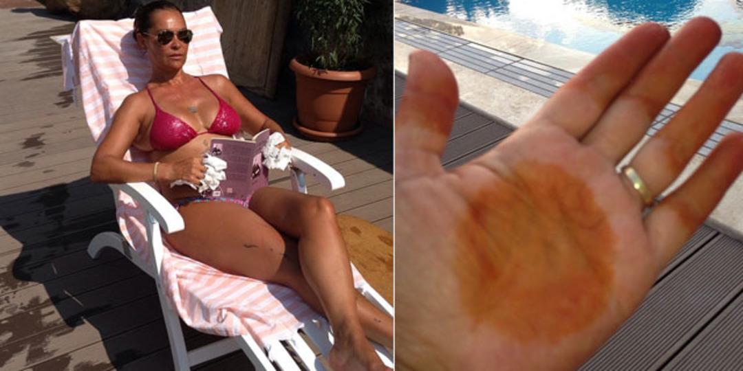 Kınanın tutmasını beklerken...