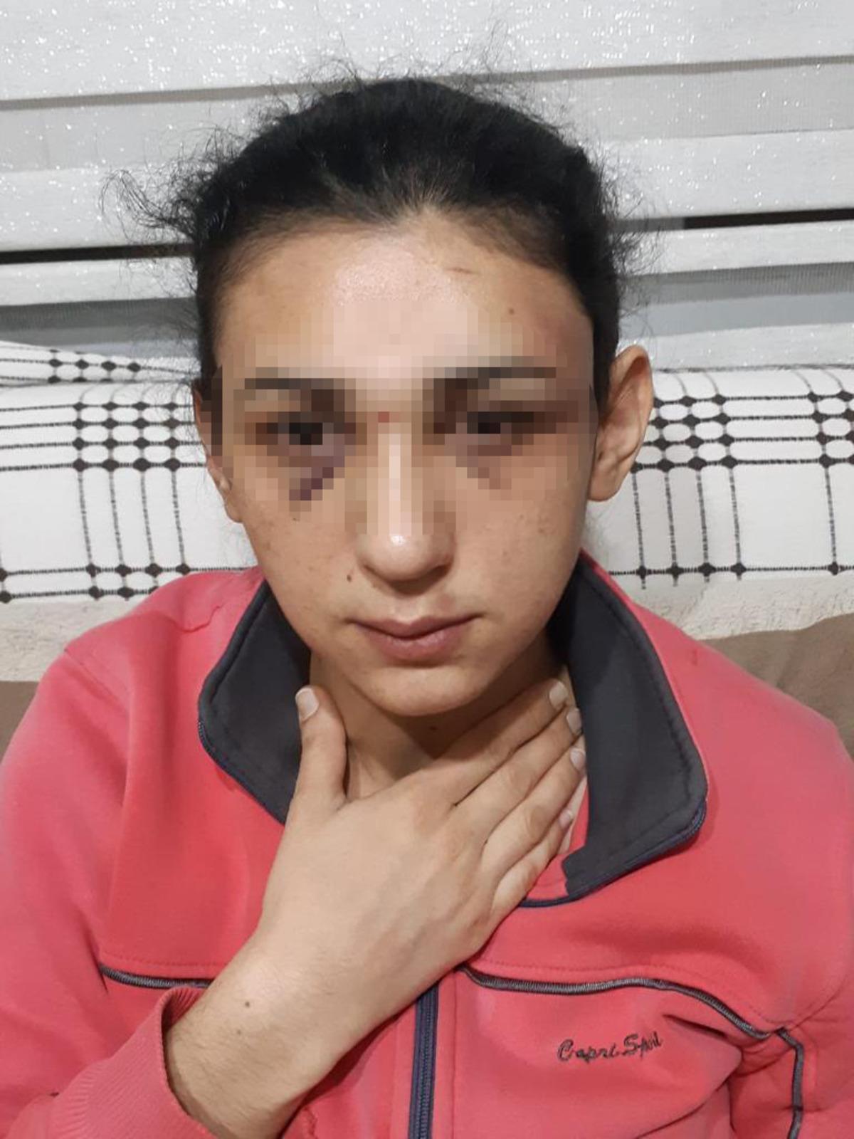 Eski eşinden şiddet g&ouml;ren kadının sosyal medyadan yardım &ccedil;ığlığı! 'Her şey i&ccedil;in &ccedil;ok ge&ccedil; olacak'