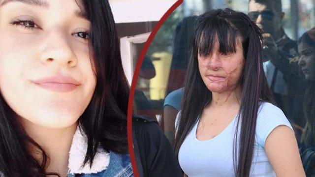 Berfin Özek'e asitle saldıran Casim Ozan Çeltik'in cezası belli oldu!