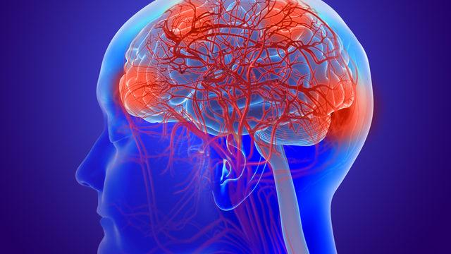 Parkinson hastalığı nedir? Parkinson belirtileri nelerdir? Parkinson tedavisinde beyin pili etkili mi?