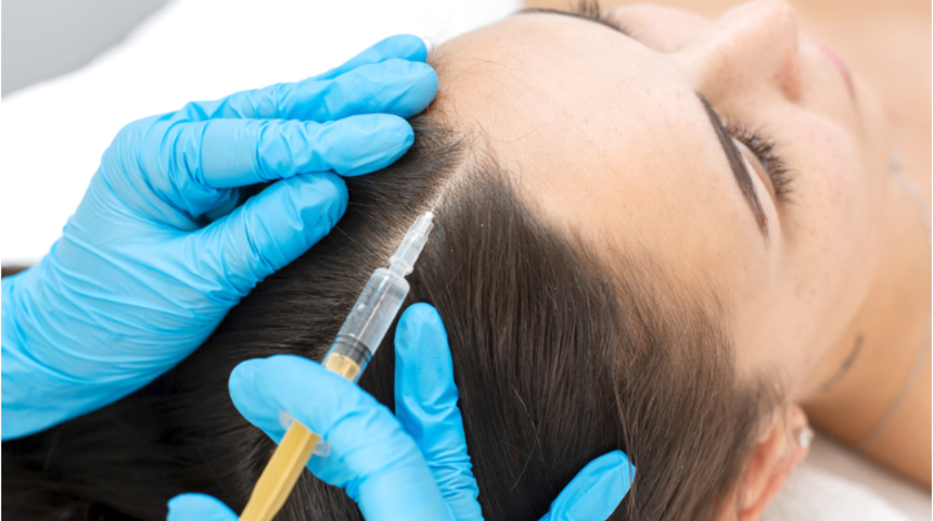 Sa&ccedil; mezoterapisi hakkında bilmeniz gerekenler