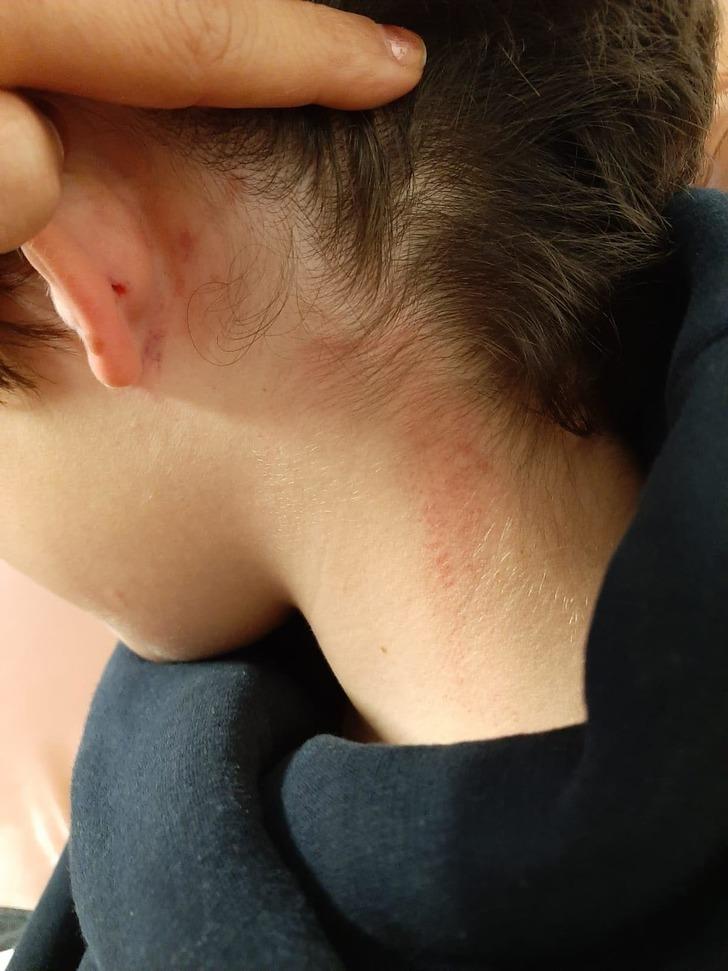 Eskişehir'de bir öğretmen 10 yaşındaki kaynaştırma öğrencisini dövdü, soruşturma başlatıldı G3