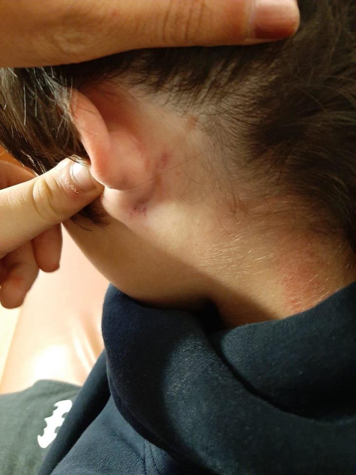 Eskişehir'de bir öğretmen 10 yaşındaki kaynaştırma öğrencisini dövdü, soruşturma başlatıldı G4