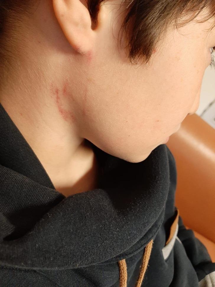 Eskişehir'de bir öğretmen 10 yaşındaki kaynaştırma öğrencisini dövdü, soruşturma başlatıldı G5