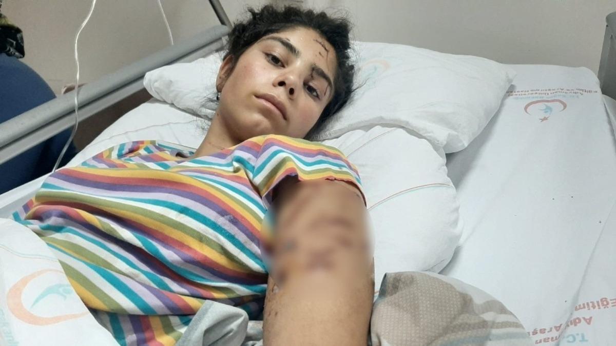 Adıyaman&rsquo;da gen&ccedil; kız dehşeti yaşadı! 8 k&ouml;pek saldırdı