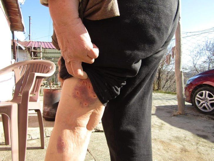 Adıyaman’da genç kız dehşeti yaşadı! 8 köpek saldırdı G2