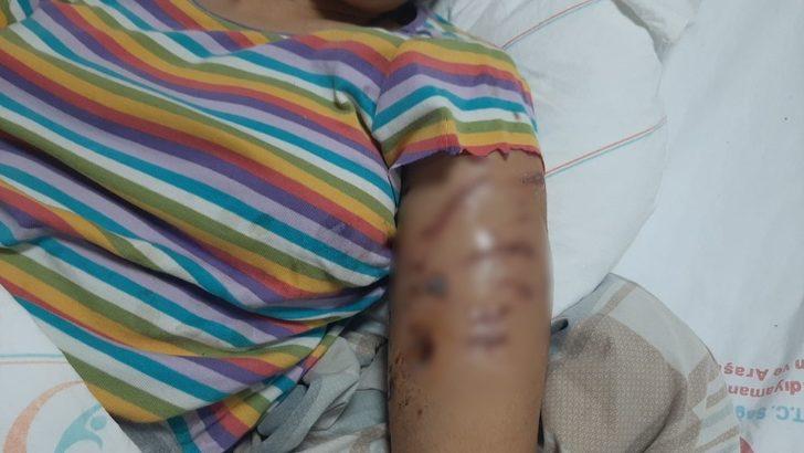 Adıyaman’da genç kız dehşeti yaşadı! 8 köpek saldırdı G5