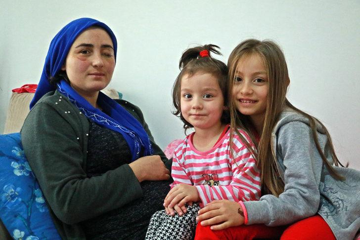 Eşi tarafından dövüldü, gözünü kaybetti! "Dünyamı kararttı" G3