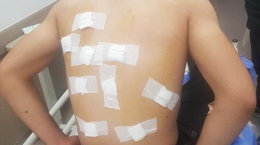 Kayseri'de kaybolan koyununu arayan gen&ccedil; avcıların hedefi oldu!