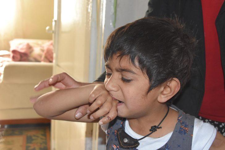 Ellerini ve kollarını ısırıyor! Aile çareyi bebek bezi bağlamakla buldu G4