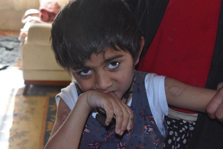 Ellerini ve kollarını ısırıyor! Aile çareyi bebek bezi bağlamakla buldu G5