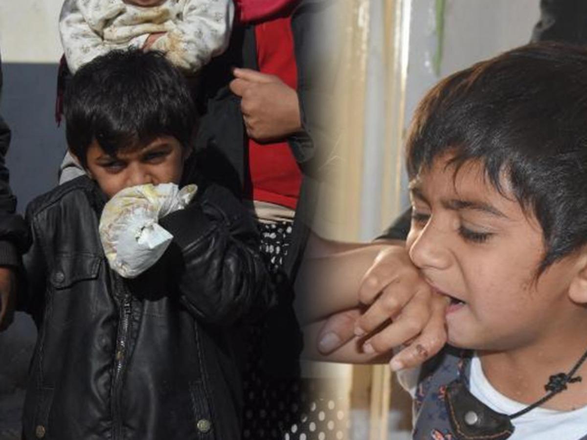 Ellerini ve kollarını ısırıyor! Aile &ccedil;areyi bebek bezi bağlamakla buldu