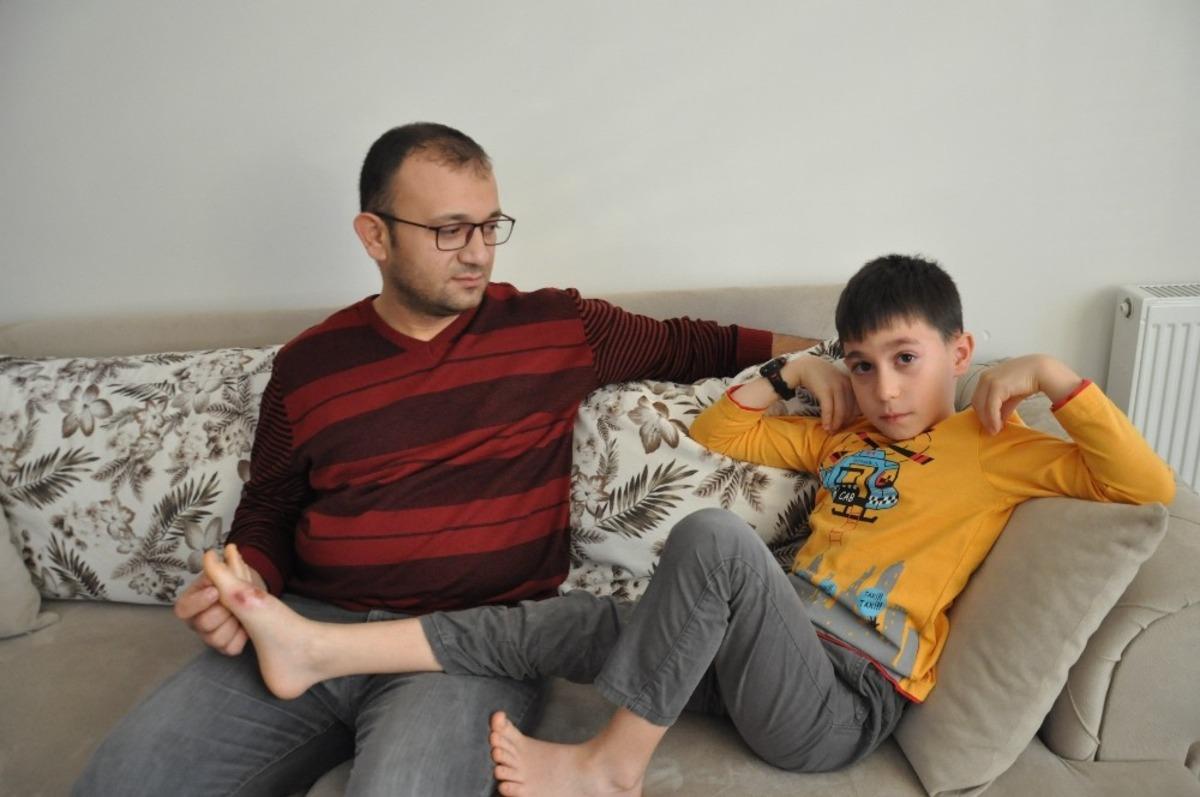 V&uuml;cudunda yanık oluşan &ouml;ğrencinin babası konuştu