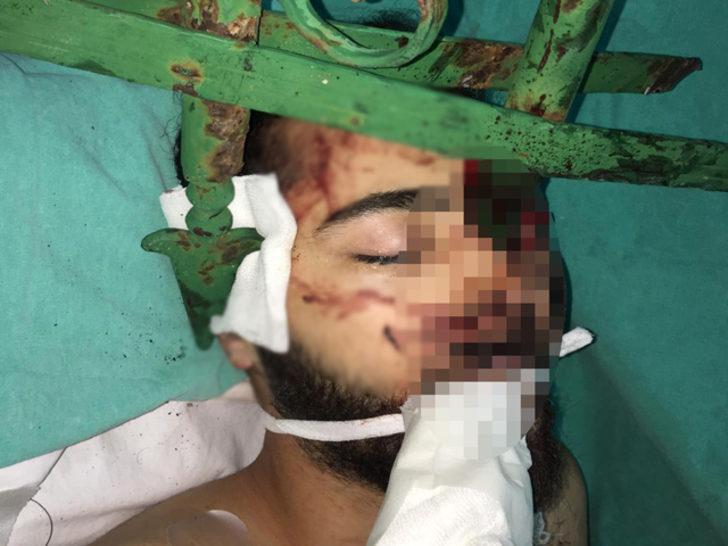 Yüzüne demir saplanmıştı! Emre'den iyi haber geldi G4