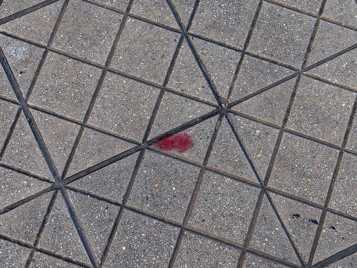 K&uuml;&ccedil;&uuml;k &ccedil;ocuk arkadaşını Valilik &ouml;n&uuml;nde &ccedil;akıyla yaraladı