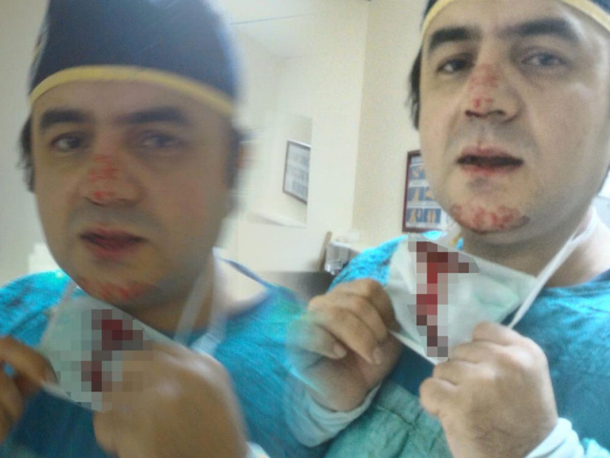 Osmaniye'de darp edilen doktor saldırganın eşine y&uuml;z&uuml; yaralı halde doğum yaptırdı