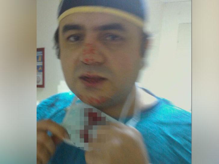 Osmaniye'de darp edilen doktor saldırganın eşine yüzü yaralı halde doğum yaptırdı G3