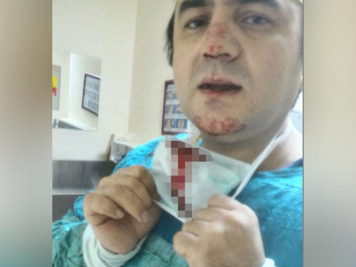 Osmaniye'de darp edilen doktor saldırganın eşine yüzü yaralı halde doğum yaptırdı G4