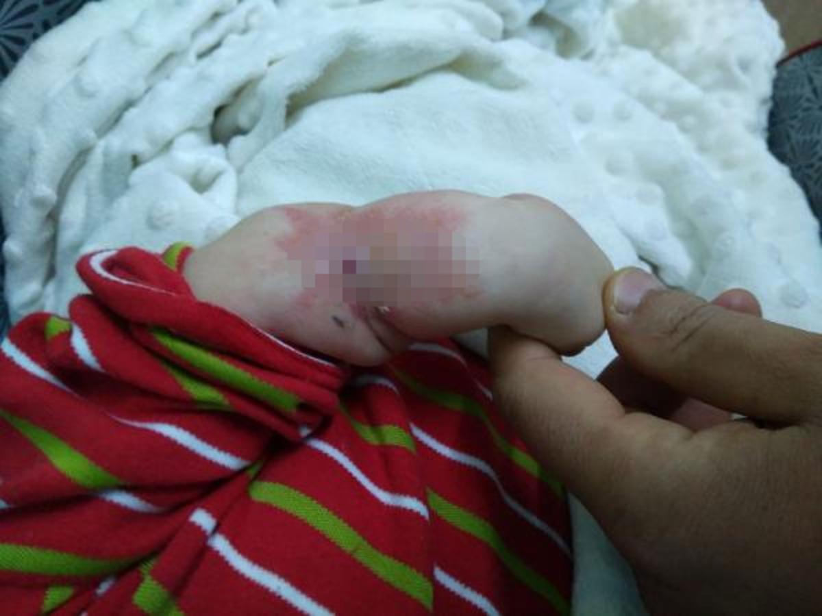 Adı İsa... Kolunda yarayla doğdu ve ne olduğu bilinmiyor