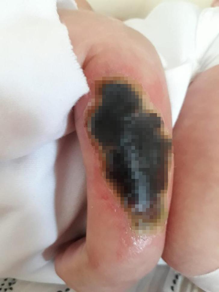 Adı İsa... Kolunda yarayla doğdu ve ne olduğu bilinmiyor G2